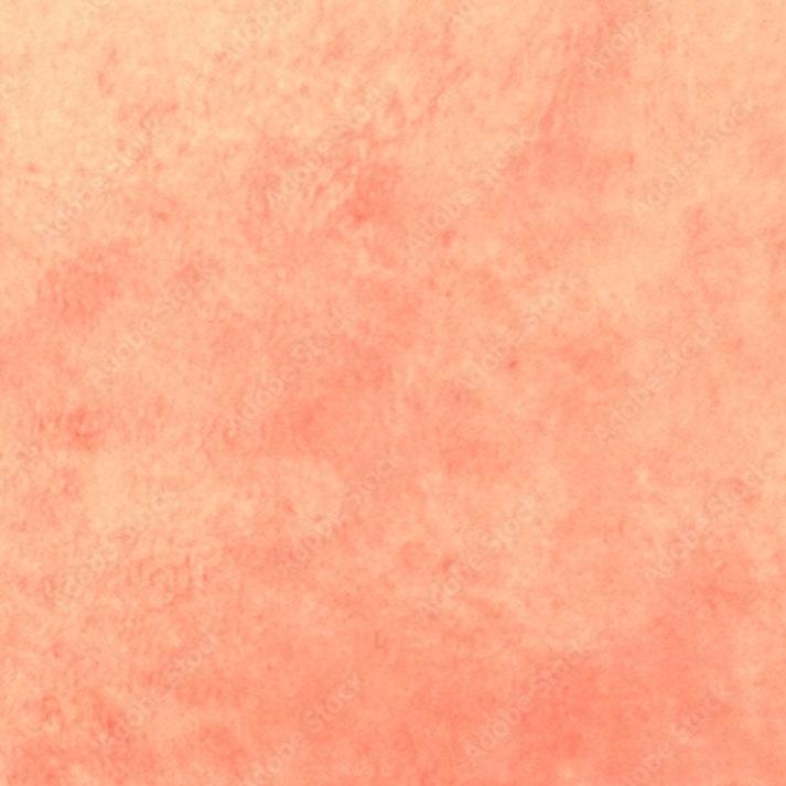 Hautpflege bei Neurodermitis