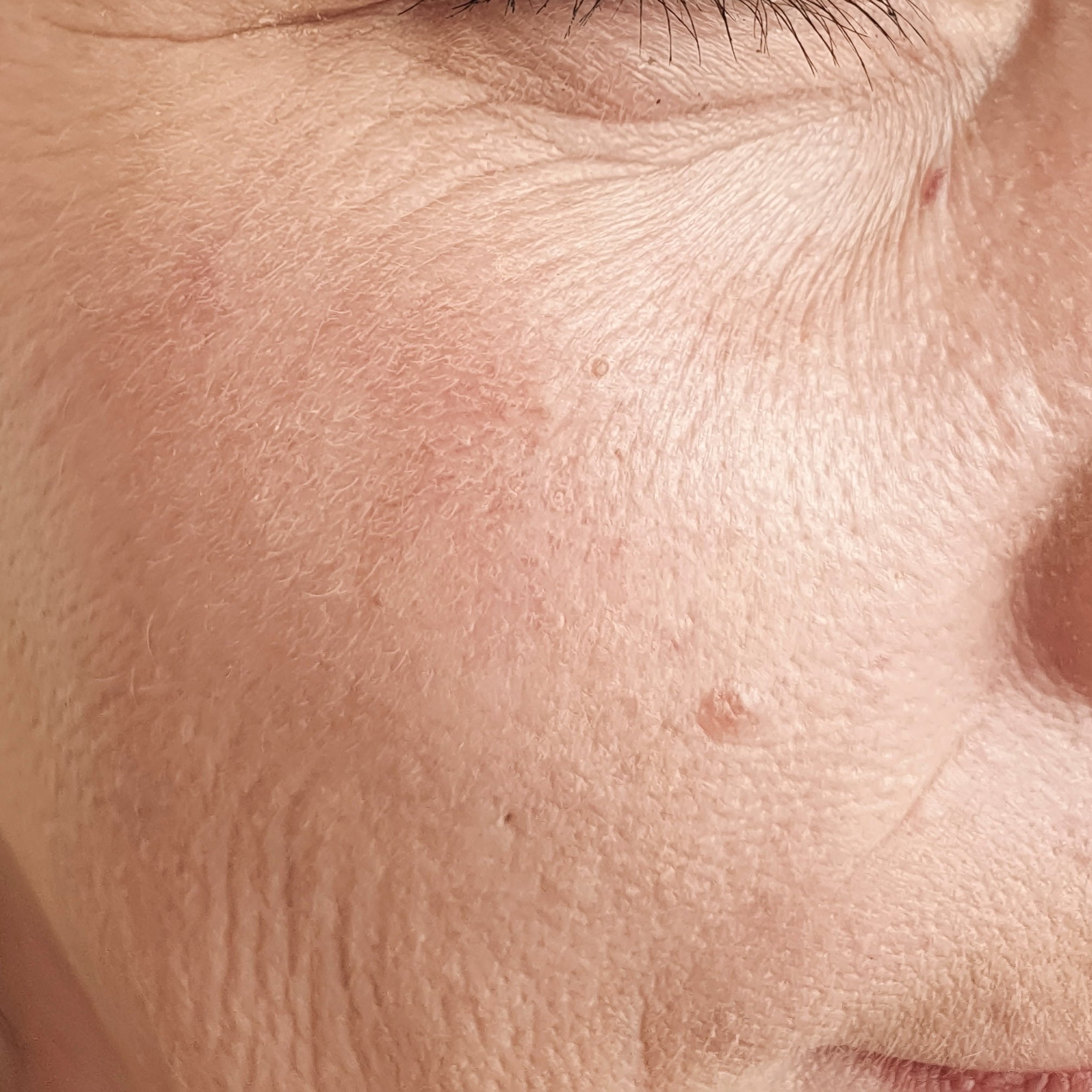 Anti-Aging und fahler Teint